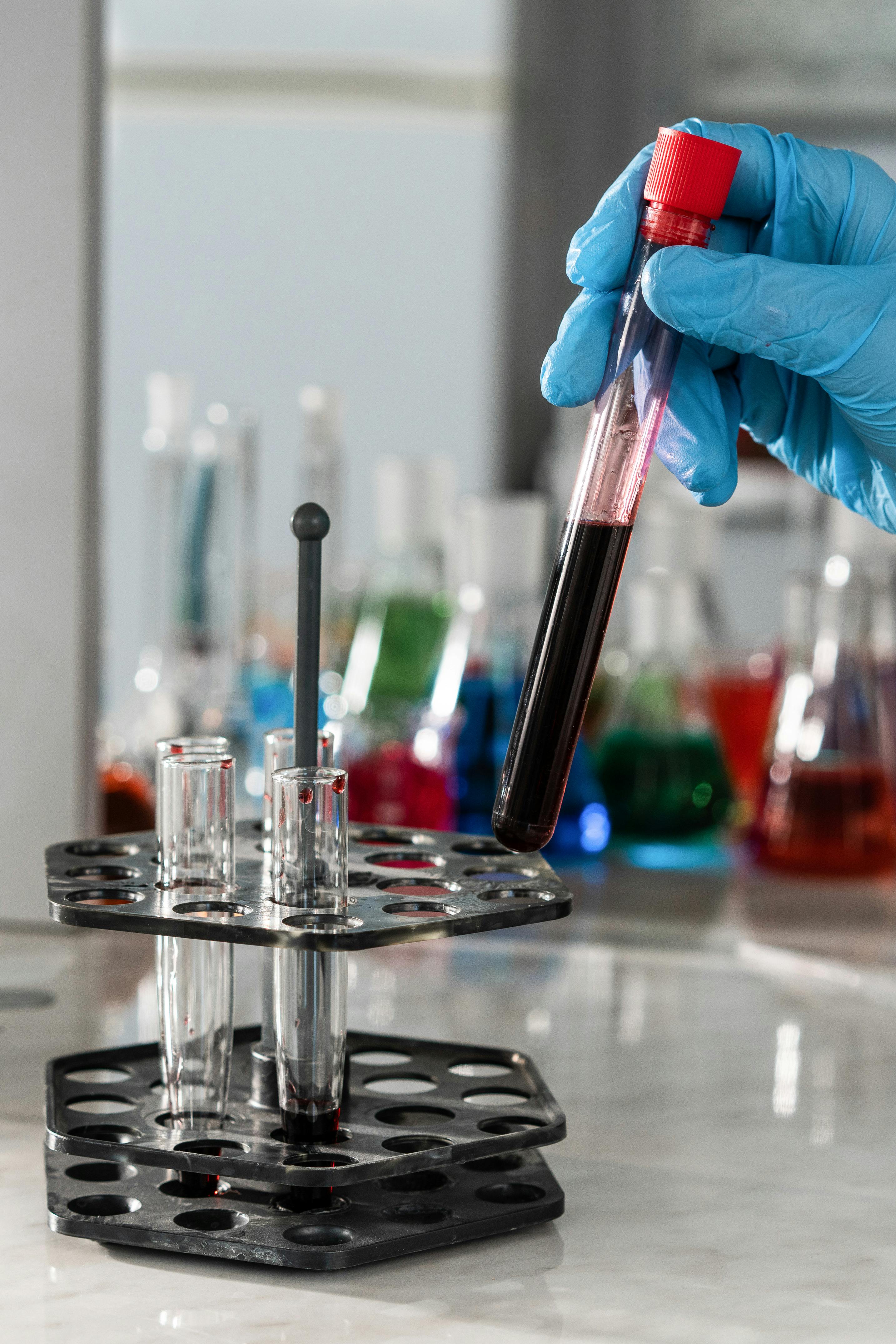 چرا بارداری باعث افزایش احتمال ابتلا به کم خونی می شود؟